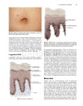 تصویر  Local Flaps in Facial Reconstruction 4e 2022