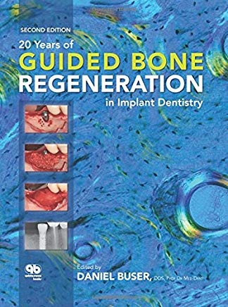 تصویر  20Years of Guided Bone Regeneration in Implant Dentistry
