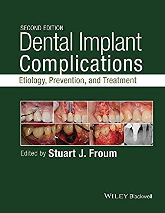 تصویر  Dental Implant Complications Etiology, Prevention, and Treatment