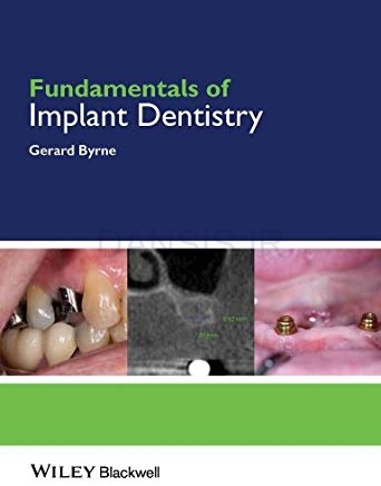 تصویر  Fundamentals of Implant Dentistry