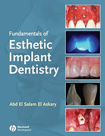 تصویر  Fundamentals of Esthetic Implant Dentistry