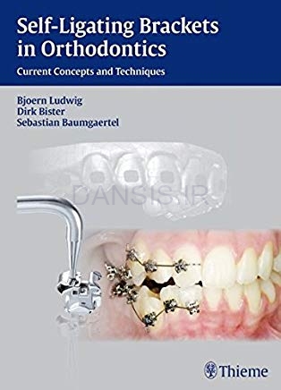 تصویر  Self-ligating Brackets in Orthodontics Current Concepts and Techniques (Thieme)