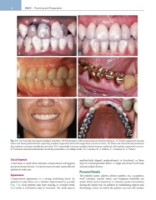 تصویر  Contemporary Fixed Prosthodontics 6e 2023