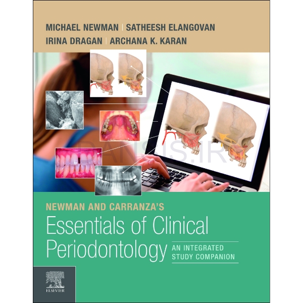 تصویر  Newman_and_Carranza’s_Essentials_of_Clinical_Periodontology_2022